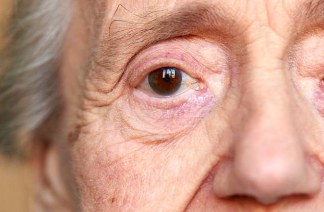 Alzheimer a través de los ojos