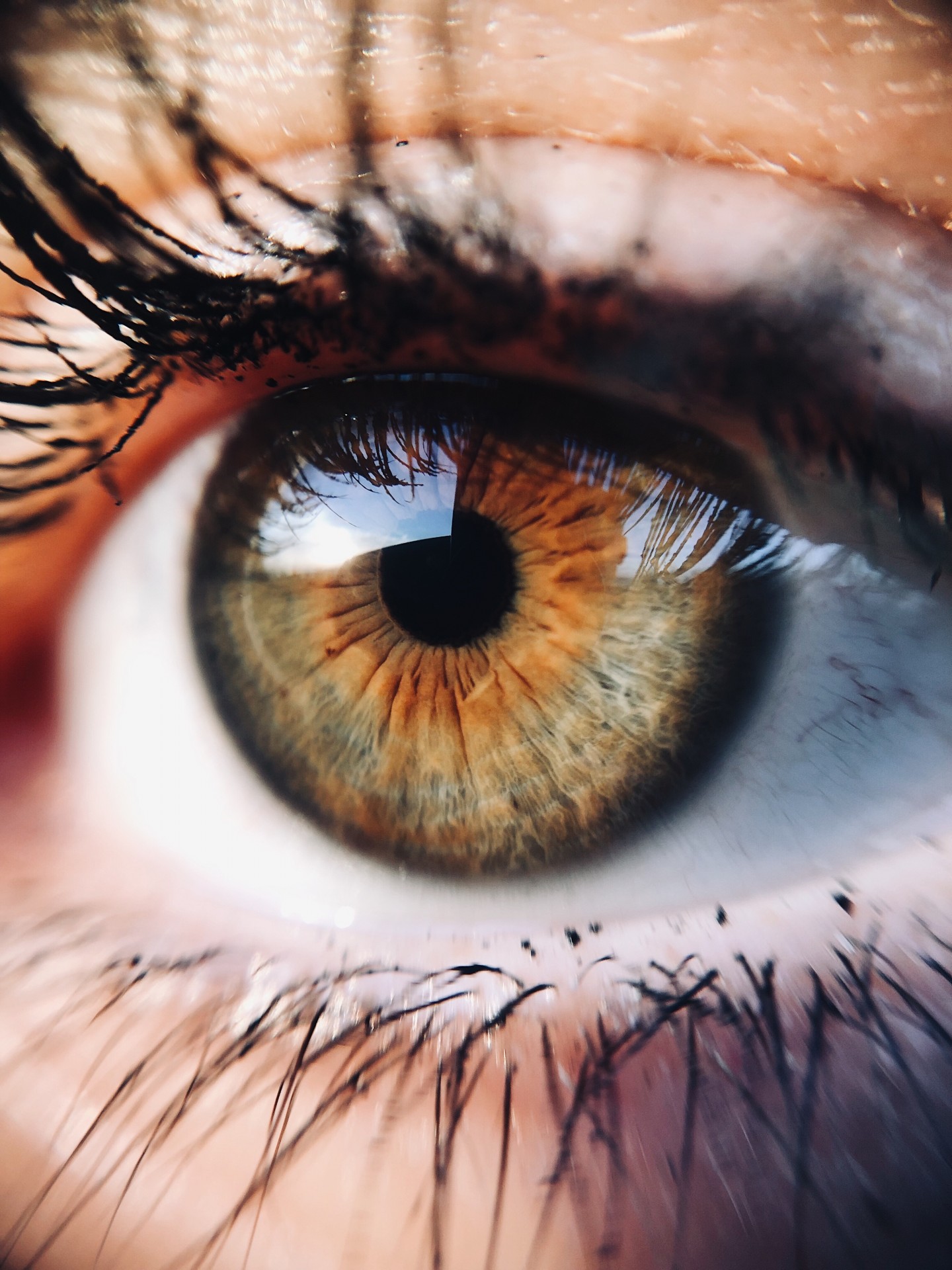 Cómo detectar el Glaucoma