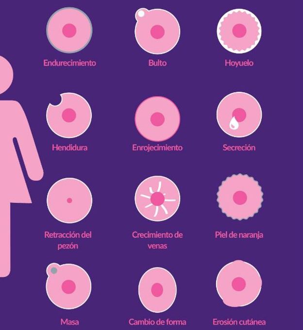 síntomas cáncer de mama